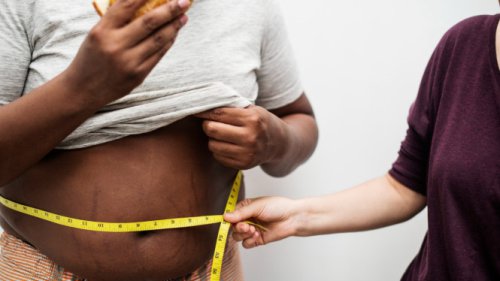 Begini Cara Tahu Kamu Obesitas atau Tidak