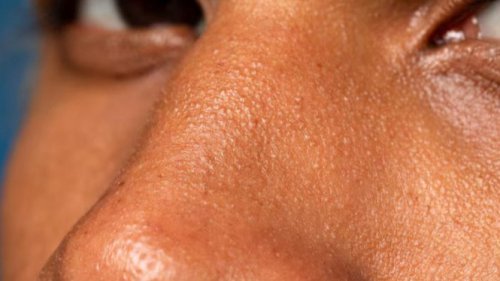 Cuaca Panas Bikin Kulit Kering? Simak 10 Bahan Skincare yang Bikin Kulit Tetap Sehat!
