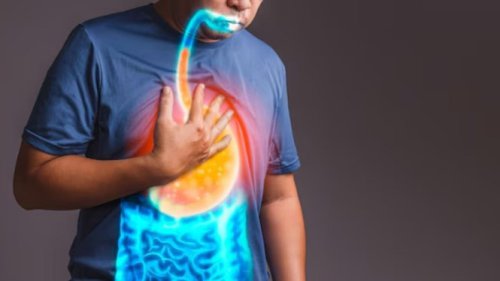 Top 5+ Cara Mengontrol Asam Lambung Saat Puasa, Gak Cuma Soal Makanan!
