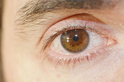 Makeup Mata yang Tak Dibersihkan Bisa Memicu Munculnya Tungau, Ini Tandanya