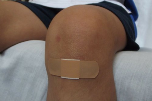 Kapan Harus Ganti Plester Luka? Ini Tandanya Menurut Dokter