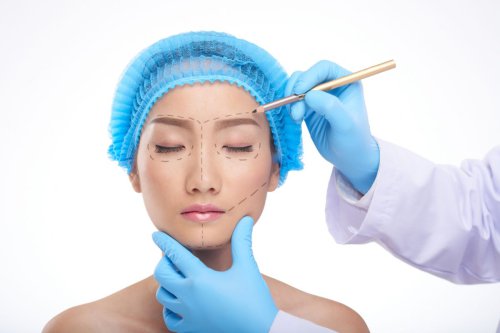 Threadlift Vs Facelift, Mana yang Pemulihannya Lebih Cepat? Ini Kata Dokter