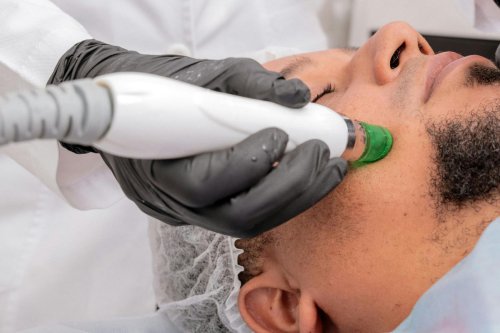 3 Perawatan untuk Masalah Kulit Wajah Pria Menurut Dokter