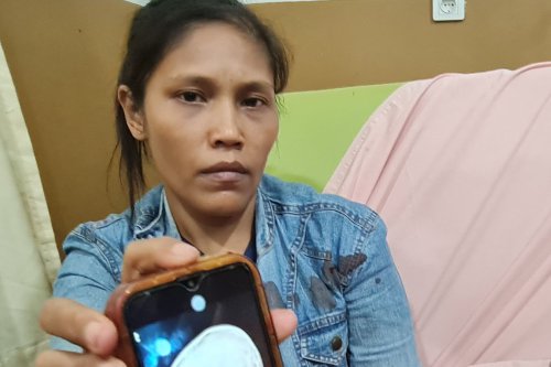 Kronologi Balita 4 Tahun di Medan Tertembak Saat Ada Tawuran, Peluru Masih Bersarang di Mata