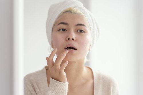 Mengapa Kulit di Sekitar Bibir Sering Kering? Ini Penyebab Umumnya