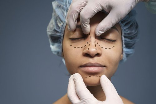 Top 5+ Hal yang Harus Diperhatikan Sebelum Operasi Hidung Rhinoplasty