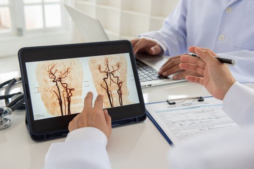 Cegah Stroke dengan Cek Aliran Darah ke Otak&nbsp;