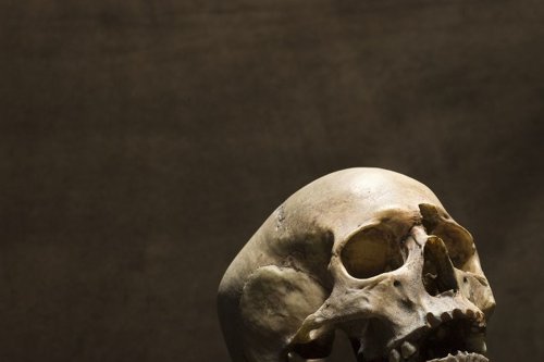 Misteri Kerangka dalam Pohon Aren di Sergai, Diduga Pemuda yang Hilang Dua Tahun Lalu