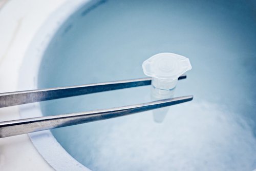Egg freezing, pembekuan sel telur, Luna Maya, egg freezing, Luna Maya egg freezing, egg freezing adalah, risiko egg freezing, membekukan sel telur, Seperti yang Dilakukan Luna Maya, Apa Risiko Egg Freezing?