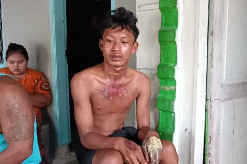 Remaja di Deli Serdang Dibakar Usai Curi Ubi: Oknum ASN Jadi Tersangka, Brimob Polda Sumut Akui Tempeleng