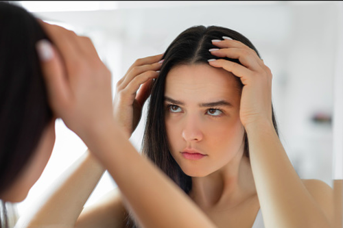 Mengenal Penyebab Ketombe Rambut dan Tips Pilih Sampo&nbsp;