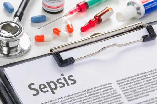 Apa Itu Sepsis? Kenali Gejala, Penyebab, dan Kasus Kematian Bocah 4 Tahun di Sukabumi