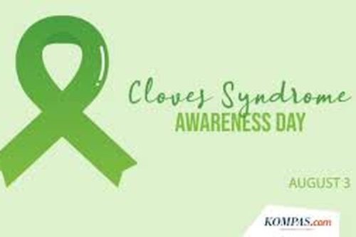 3 Agustus Memperingati Hari Apa? Ada Peringatan Sindrom Cloves
