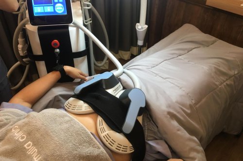 Cryo Slimming Pro, Treatment untuk Mengecilkan Lingkar Perut Tanpa Operasi