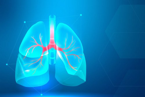 kanker paru, tumor di paru, VATS, Mengapa Tumor di Paru Sering Tak Disadari?