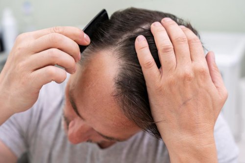 Manfaat Kondisioner Rambut Menurut Dr. Tirta, Menjaga agar Tak Kering