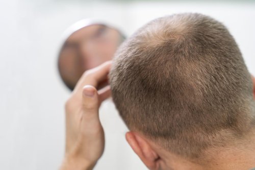 Inovasi Baru dari Korea Jadi Senjata Baru Atasi Kerontokan Rambut