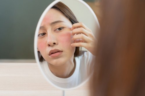 4 Penyebab Kulit Sensitif, Bisa dari Faktor Lingkungan