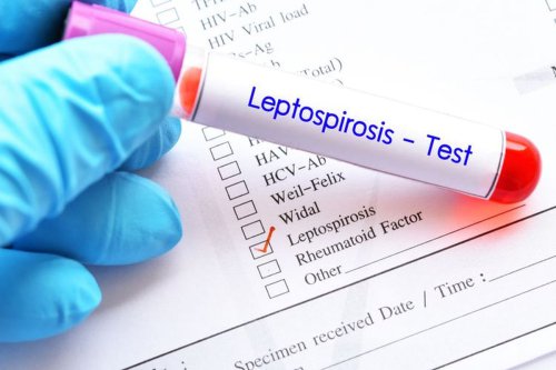 3 Warga Gunungkidul Meninggal akibat Leptospirosis, Kenali Gejala Demam yang Khas