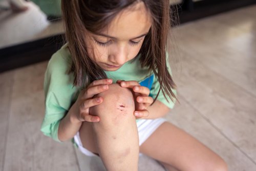 Mengoleskan Air Liur untuk Luka Anak, Amankah? Ini Kata Dokter