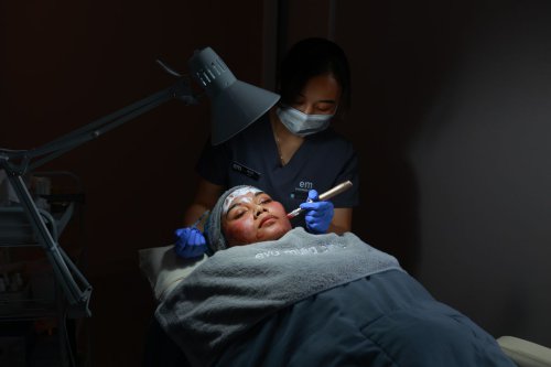 Eva Mulia Clinic, jerawat, Eva Mulia Clinic Depok, Perawatan untuk Atasi Jerawat dari Ringan hingga Parah, Ini Saran Dokter