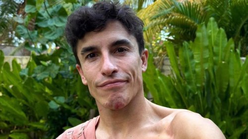 Dokter Ungkap Cedera Serius Marc Marquez, Ada Sekrup Bengkok