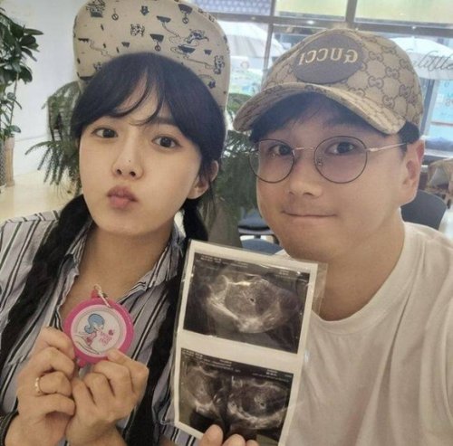 カン・ウンビ、妊娠21週で流産したことを明かす「泣くことしかできなかった」（動画あり）