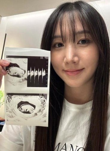 元Apink ホン・ユギョン、妊娠を発表！「素敵なお母さんになる」