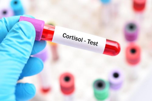 I Got a Cortisol Blood Test. What I Learned About My Stress Was Important, but Not Fun