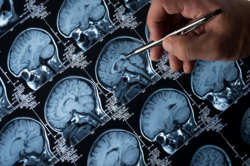 How a hated bacteria could protect the brain from Alzheimer&rsquo;s disease