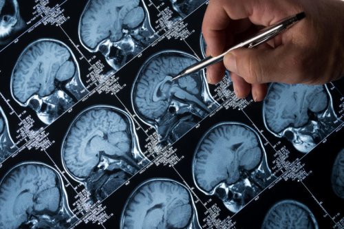How a hated bacteria could protect the brain from Alzheimer&rsquo;s disease