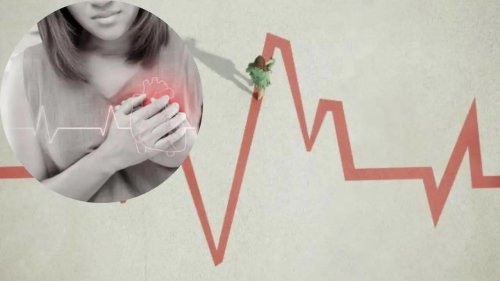 Doctor Shares an Unusual Symptom of Heart Attack, Which Is Particularly Common in Women