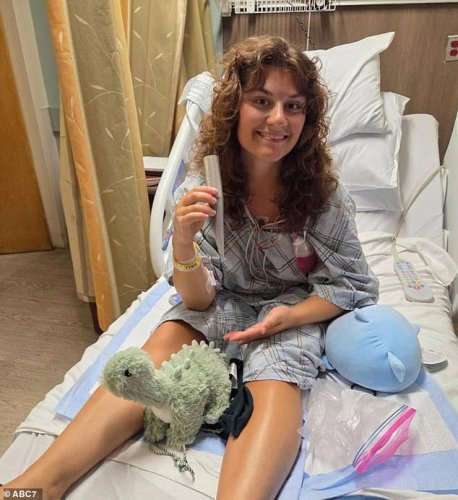 Glamorous lifeguard impaled by beach umbrella speaks out from hospital to relive freak accident