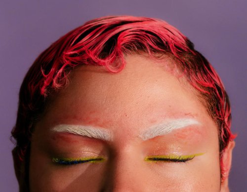 Women Are Saving Thousands of Dollars With DIY Beauty Procedures. It&rsquo;s Not Always Pretty.