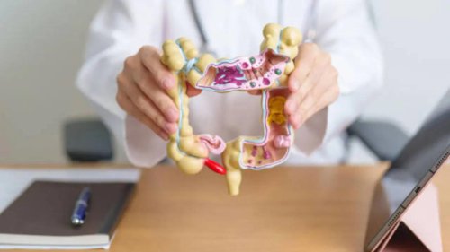 What is Diverticulitis? 5 Habits to Help You Lower It (Even If It Runs in Your Family)