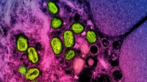 Urgent alert after rare virus case detected