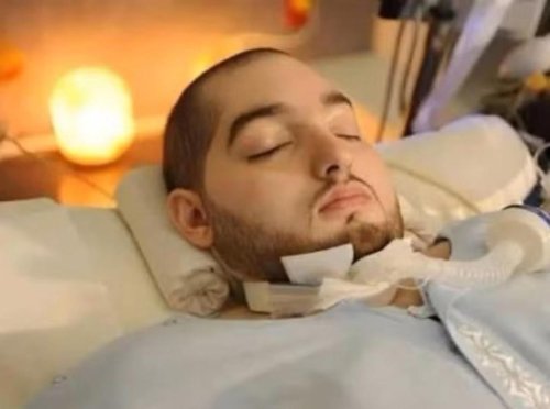 Saudi Prince dies after 20 years in a coma