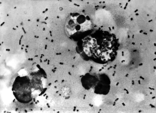 US resident dies from plague, officials say