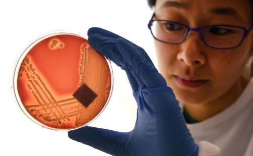Superbugs could kill millions by 2050, study shows
