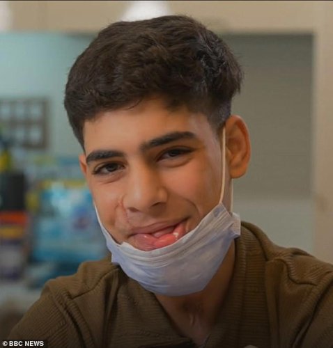Teenage boy who was maimed in Gaza becomes the first to be treated for war injuries in the UK
