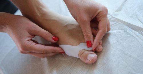 What causes bunions, and how can you get rid of them?