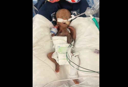 Iowa boy born at 21 weeks is now the world&rsquo;s most premature baby