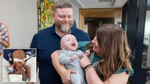 Baby born at just 21 weeks celebrates first birthday