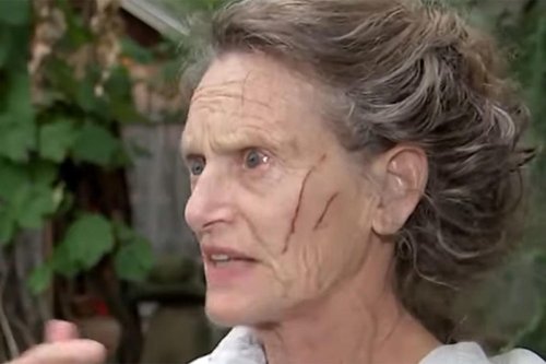 Woman Attacked by Raccoon Outside Her Home as She Was Letting Her Dogs Out