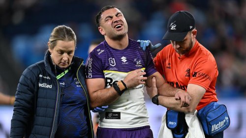 Storm star&rsquo;s act eases injury fears