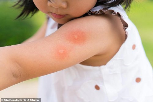 CDC issues another travel advisory over deadly chikungunya virus as it spreads from China