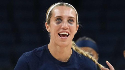 Lexie Hull Has Fitting 4-Word Response to Fever Fan Black Eye Halloween Costumes