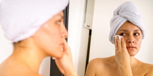 The most effective treatments for under-eye circles, according to experts