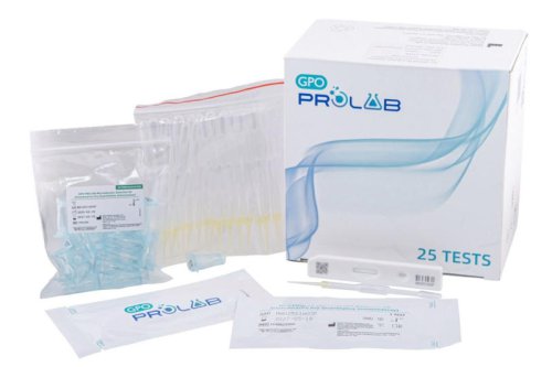 หยุดโรคไตก่อนสายเกินไป อภ. ชู ไมโครอัลบูมิน&ndash;GPO Prolab เพิ่มโอกาสรักษาไตทันเวลา