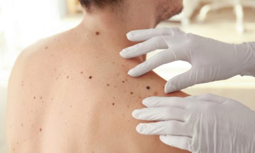 Top 10+ Rekomendasi Dokter Kulit Kebumen Yang Terjangkau dan Siap Membuat Kulitmu Sehat Terawat